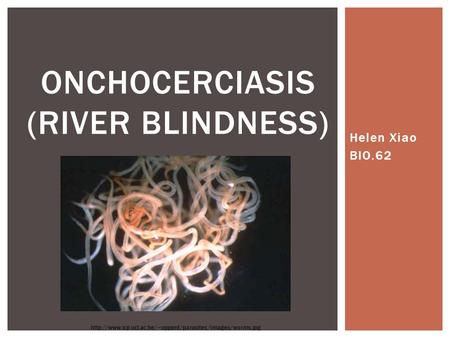 Onchocerciasis (River Blindness)