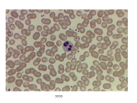 ????. Neutrophil ???? Neutrophils ???? Neutrophil.