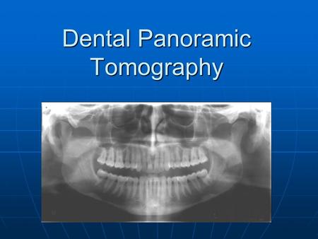 Dental Panoramic Tomography