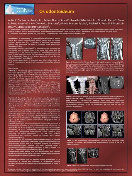 Os odontoideum Antônio Santos de Araújo Jr. 1, Pedro Alberto Arlant 1, Arnaldo Salvestrini Jr. 1, Orlando Parise 2, Paulo Roberto Lazarini 3, Carlo Domenico.