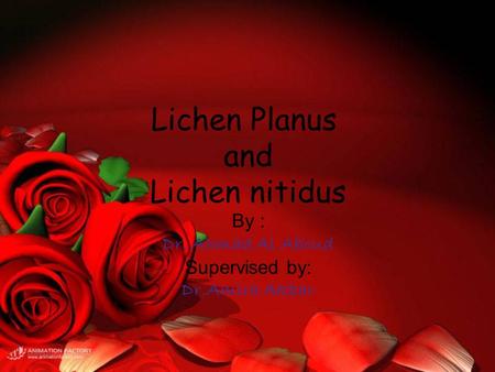 Lichen Planus and Lichen nitidus By : Dr. Ahmad Al Aboud Supervised by: Dr.Amira Akbar.