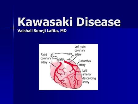 Kawasaki Disease Vaishali Soneji Lafita, MD. Presentation – Patient 1 10 years old male with Kawasaki Disease 10 years old male with Kawasaki Disease.