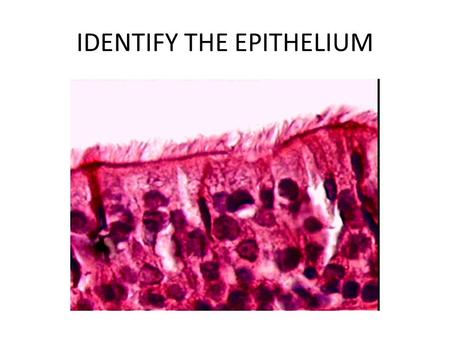 IDENTIFY THE EPITHELIUM. PSEUDOSTRATIFIED COLUMNAR.