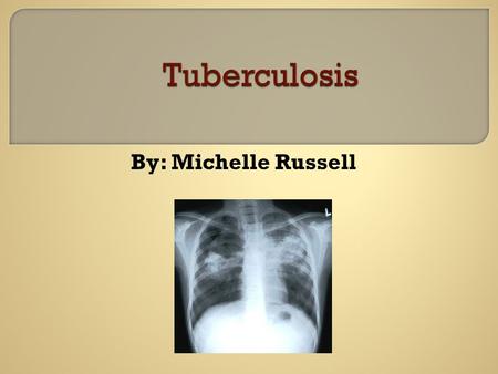 By: Michelle Russell.  To become familiar with the disease process of TB Transmission symptoms Precautions  Nursing Diagnoses  Interventions.