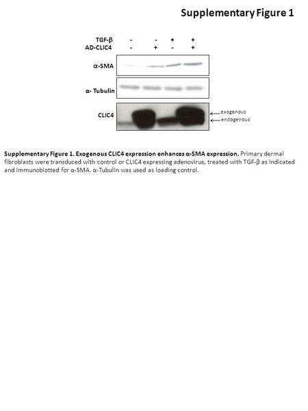  -SMA α- Tubulin CLIC4 AD-CLIC4 - + - + TGF-  - - + + Supplementary Figure 1 Supplementary Figure 1. Exogenous CLIC4 expression enhances α-SMA expression.