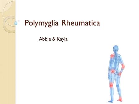 Polymyglia Rheumatica Abbie & Kayla. What PMR is: o Polymyalgia Rheumatica (or PMR) is a syndrome that involves having intense pain in your muscles. Especially.