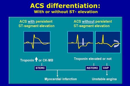 ACS differentiation: With or without ST- elevation STEMI NSTEMI UAP.