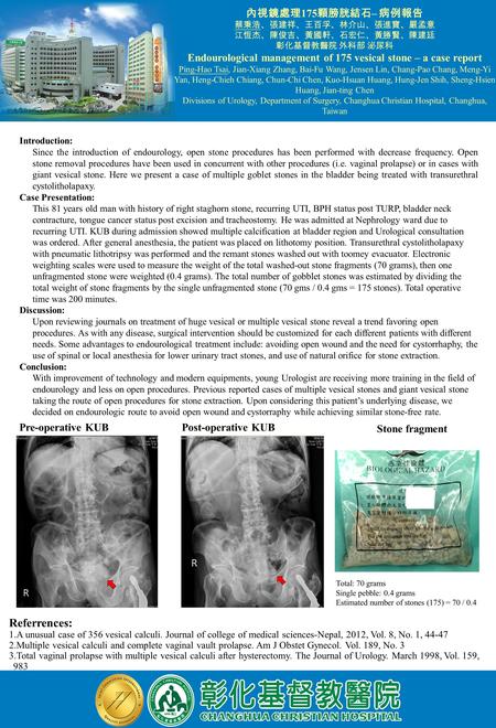 Introduction: Since the introduction of endourology, open stone procedures has been performed with decrease frequency. Open stone removal procedures have.