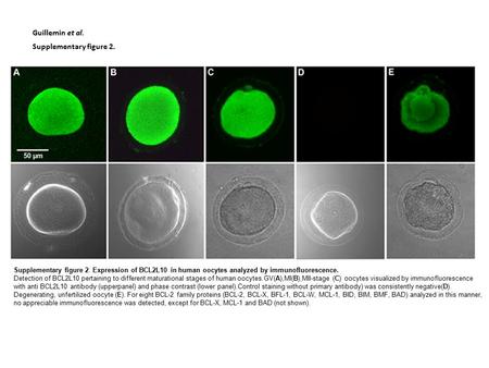 Supplementary figure 2. Guillemin et al. Supplementary figure 2. Expression of BCL2L10 in human oocytes analyzed by immunofluorescence. Detection of BCL2L10.