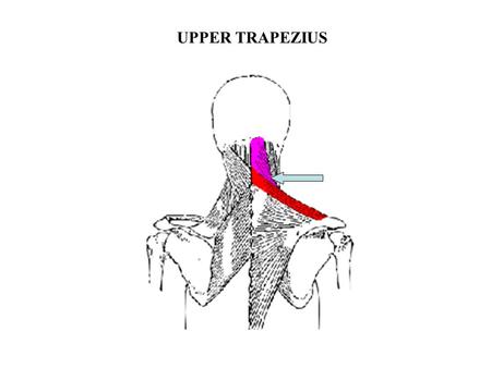 UPPER TRAPEZIUS. MIDDLE TRAPEZIUS LOWER TRAPEZIUS.