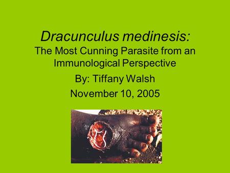 Dracunculus medinesis: The Most Cunning Parasite from an Immunological Perspective By: Tiffany Walsh November 10, 2005.