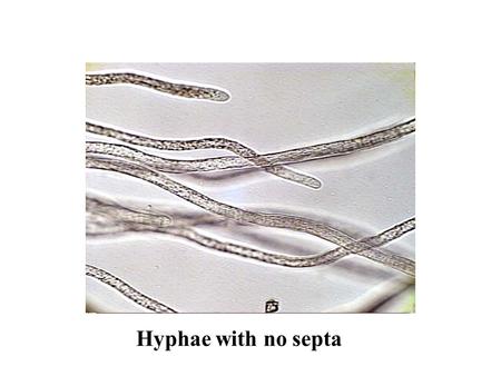 Hyphae with no septa. Pore Type within Septum Secreted Catalyst.