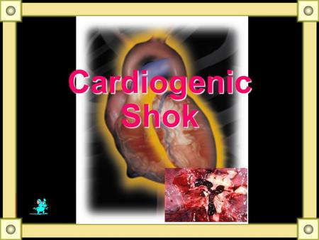 Cardiogenic Shok Some Notes Develops in 10% to 20% of patients hospitalized AMI Mortality of such patients approximately 80% or higher Very few patients.