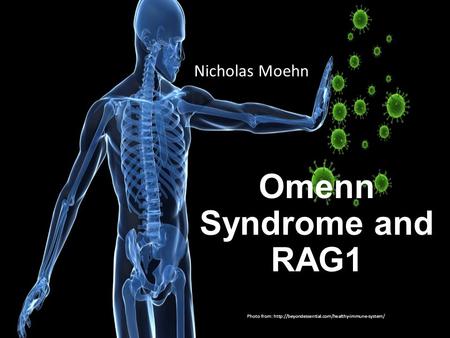 Omenn Syndrome and RAG1 Nicholas Moehn Photo from: