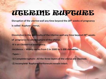 UTERINE RUPTURE Disruption of the uterine wall any time beyond the 28th weeks of pregnancy is called Rupture Uterus. Dissolution in the continuity of.