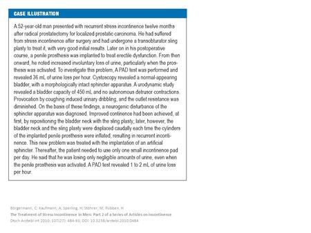 Börgermann, C; Kaufmann, A; Sperling, H; Stöhrer, M; Rübben, H The Treatment of Stress Incontinence in Men: Part 2 of a Series of Articles on Incontinence.