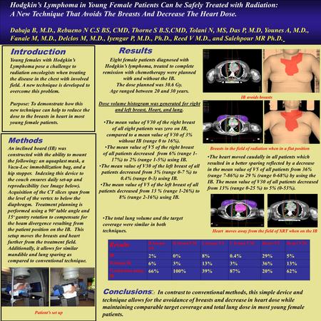 Hodgkin’s Lymphoma in Young Female Patients Can be Safely Treated with Radiation: A New Technique That Avoids The Breasts And Decrease The Heart Dose.