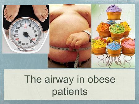 The airway in obese patients