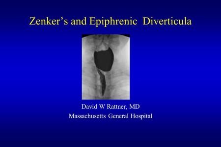 Zenker’s and Epiphrenic Diverticula