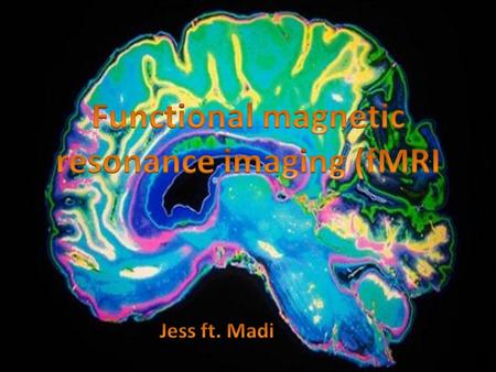 What is fMRI? Functional magnetic resonance imaging is a type of MRI scanning that assesses neural activity within the brain by producing images highlighting.