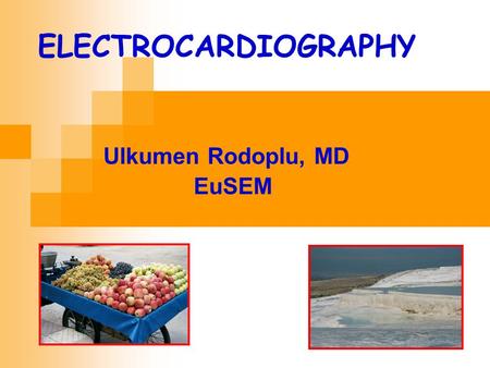 Ulkumen Rodoplu, MD EuSEM ELECTROCARDIOGRAPHY. Plan A Normal ECG Basic ECG Waveform Initiation of Spread of Electrical Activation in the Hearth The Magnitude.