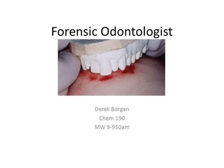 Forensic Odontologist Derek Borgen Chem 190 MW 9-950am.