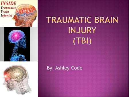 Traumatic Brain Injury (TBI)