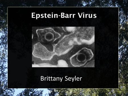 Epstein-Barr Virus Brittany Seyler.