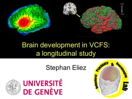 Brain development in VCFS: a longitudinal study