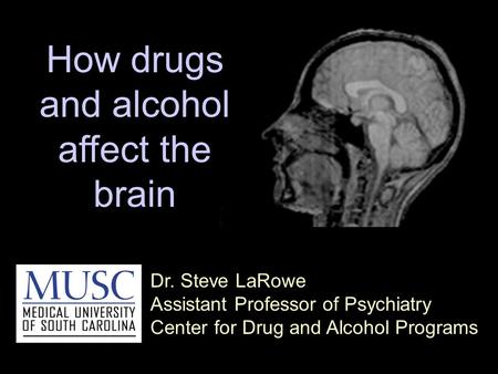 Dr. Steve LaRowe Assistant Professor of Psychiatry Center for Drug and Alcohol Programs How drugs and alcohol affect the brain.