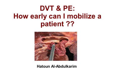 DVT & PE: How early can I mobilize a patient ??