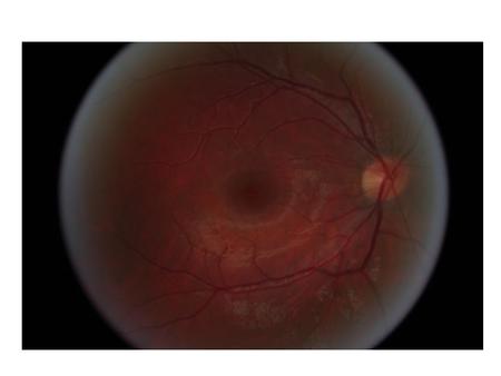 5 in 5 Name three parts of the eye What part controls the amount of light that enters the eye? What is the name of the nerve that brings the information.