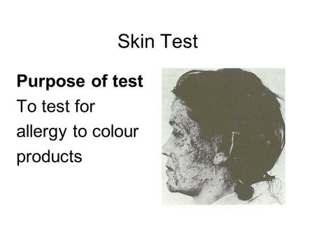 Skin Test Purpose of test To test for allergy to colour products.