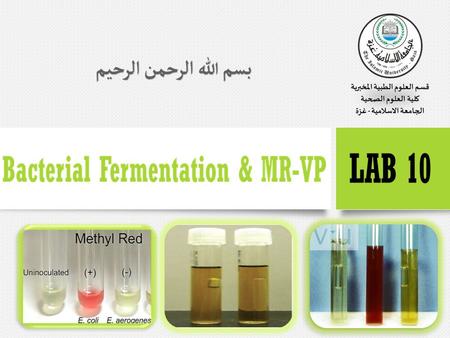 Bacterial Fermentation  Microbial metabolic processes are complex, but they permit the microbiologist to distinguish among microorganisms grown in culture.