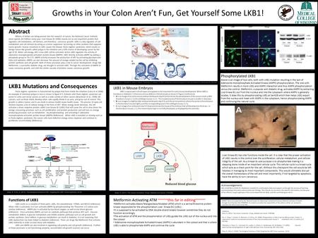 Growths in Your Colon Aren’t Fun, Get Yourself Some LKB1! Abstract Billions of dollars are being poured into the research of cancer, the National Cancer.