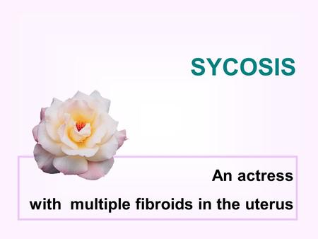 An actress with multiple fibroids in the uterus SYCOSIS.