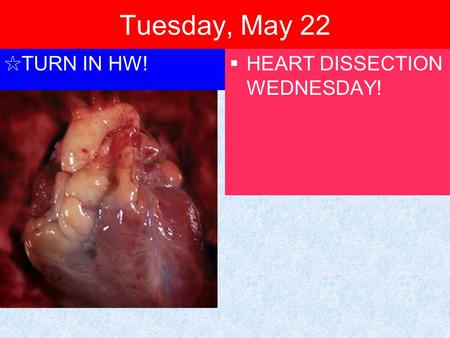 Tuesday, May 22 ✩ TURN IN HW!  HEART DISSECTION WEDNESDAY!