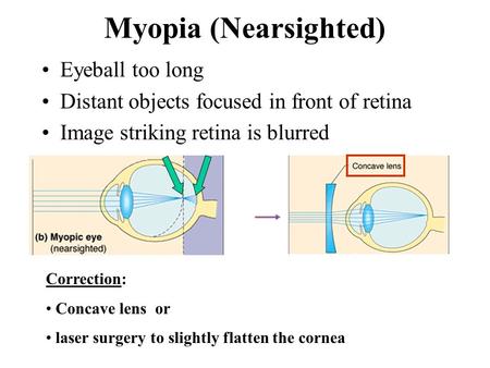 Myopia (Nearsighted) Eyeball too long Distant objects focused in front of retina Image striking retina is blurred Correction: Concave lens or laser surgery.