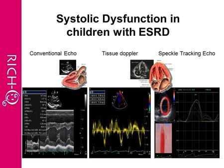 Systolic Dysfunction in children with ESRD Conventional EchoTissue dopplerSpeckle Tracking Echo.