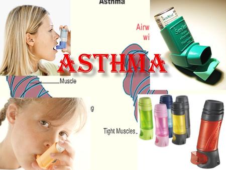 Asthma.