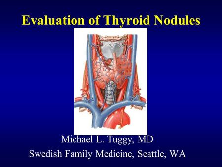 Evaluation of Thyroid Nodules