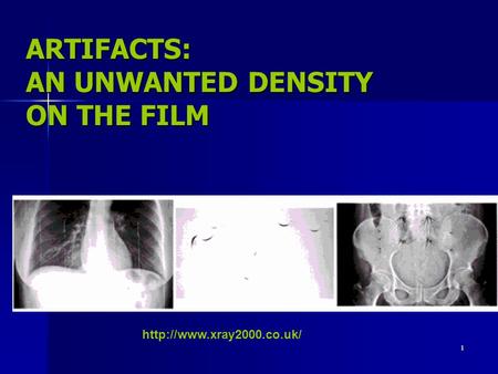 1 ARTIFACTS: AN UNWANTED DENSITY ON THE FILM