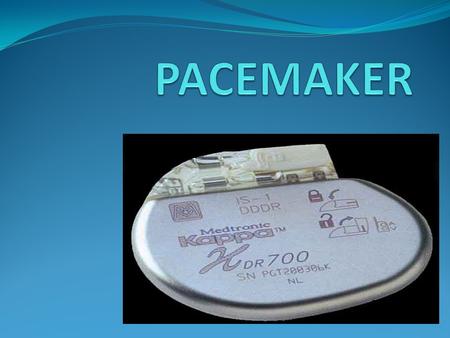 NEED FOR CARDIAC PACEMAKER Rhythmic beating of heart originates from SA node If SA node doesn’t function properly results in decreased heart rate & change.