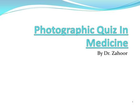 By Dr. Zahoor 1. Question 1: 1.What do you observe in this male patient? 2.Give one cause. 2.