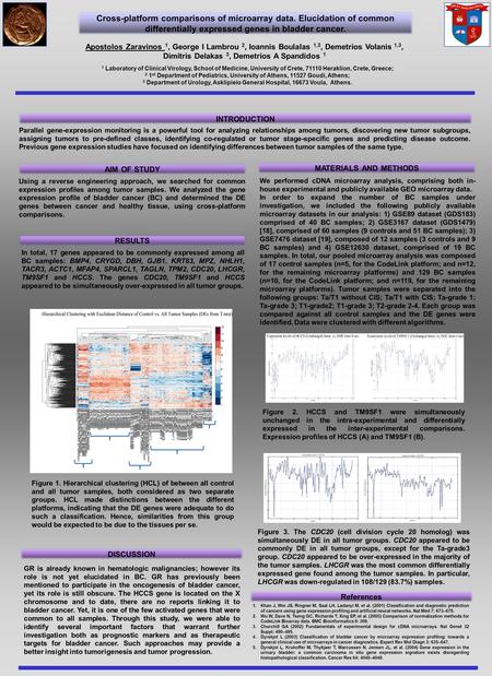 Cross-platform comparisons of microarray data. Elucidation of common differentially expressed genes in bladder cancer. Apostolos Zaravinos 1, George I.