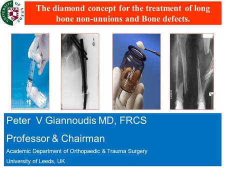 Peter V Giannoudis MD, FRCS Professor & Chairman