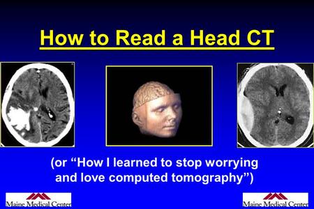 (or “How I learned to stop worrying and love computed tomography”)