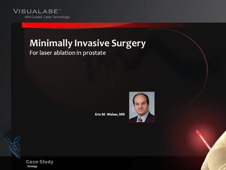 Case Study Urology Minimally Invasive Surgery For laser ablation in prostate Eric M. Walser, MD.