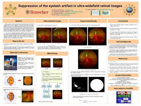 Suppression of the eyelash artifact in ultra-widefield retinal images Vanessa Ortiz-Rivera – Dr. Badrinath Roysam, Advisor –