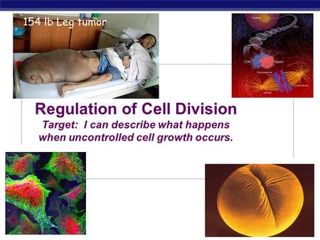 154 lb Leg tumor Regulation of Cell Division Target: I can describe what happens when uncontrolled cell growth occurs. 2008-2009.